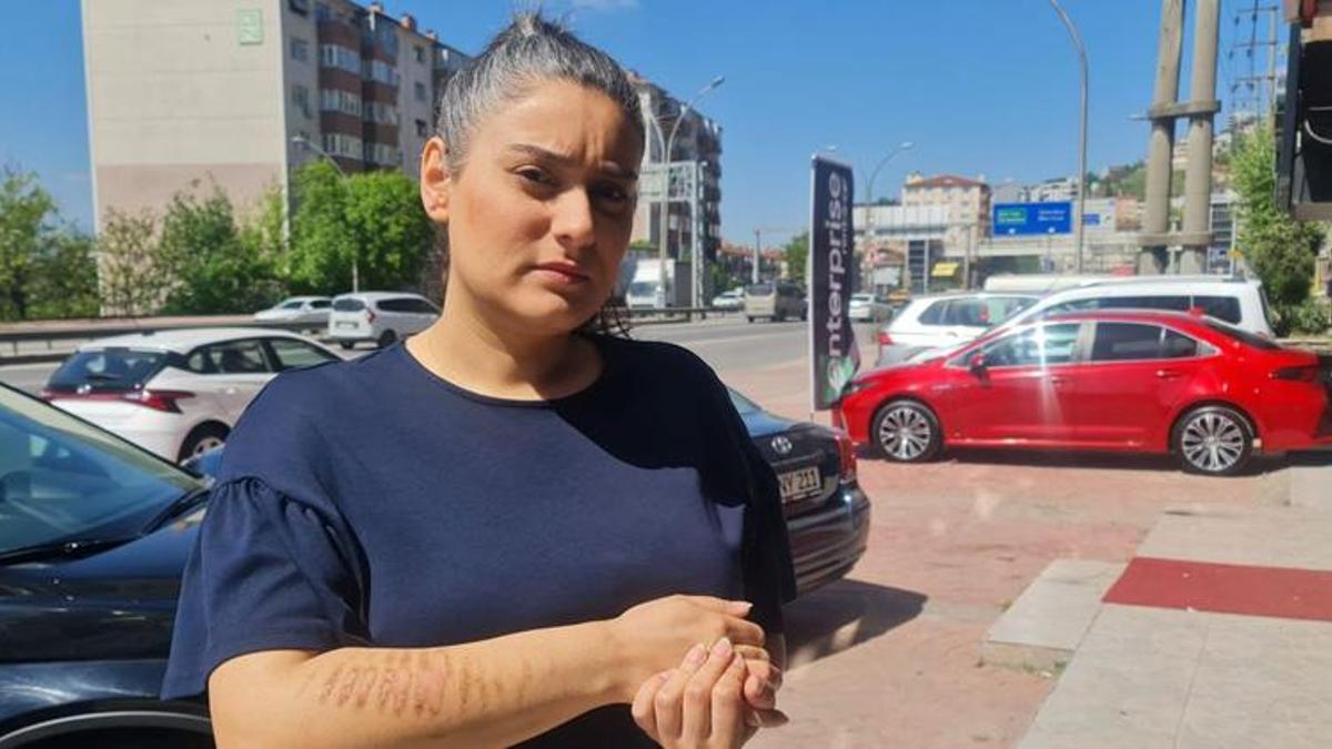 Epilasyon için gittiği güzellik merkezinde dehşeti yaşadı! 'Bu kolla mı gelinlik giyeceğim?'