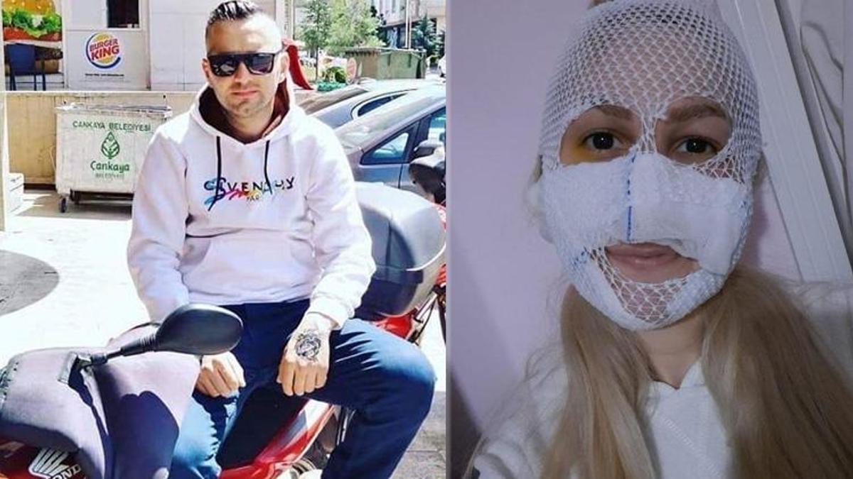 Kız arkadaşının yüzüne kimyasal madde atmıştı! 'Bütün kadınlardan özür dilerim'