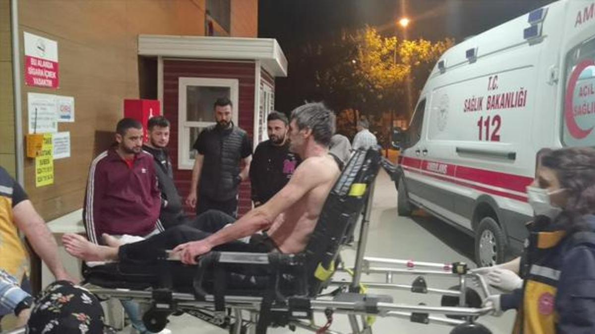 Üzerine asit dökülen işçi ağır yaralandı