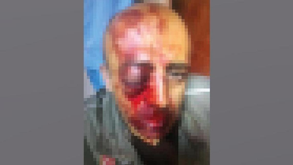 Orman memurunu tanınmaz hale getirdiler! Çok sayıda kişi gözaltına alındı