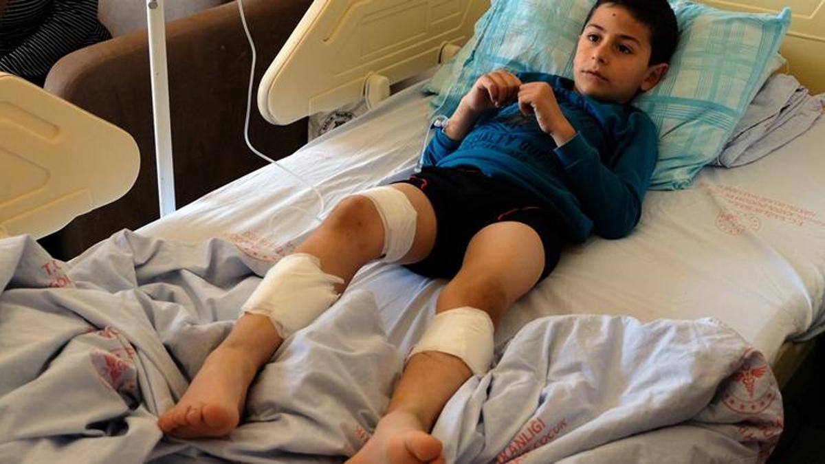 Sokak köpeklerinin saldırısına uğrayan küçük Mustafa yaralandı