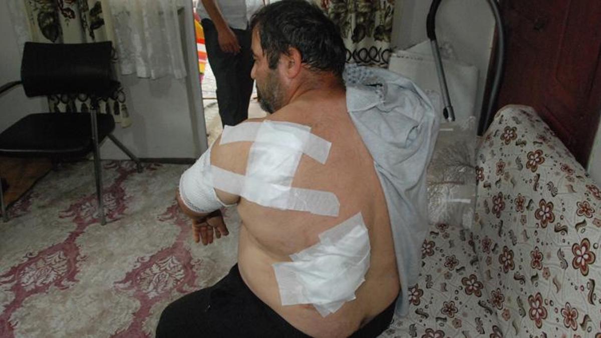 Ayının saldırdığı işçi: Öldüğümü sanıp bıraktı