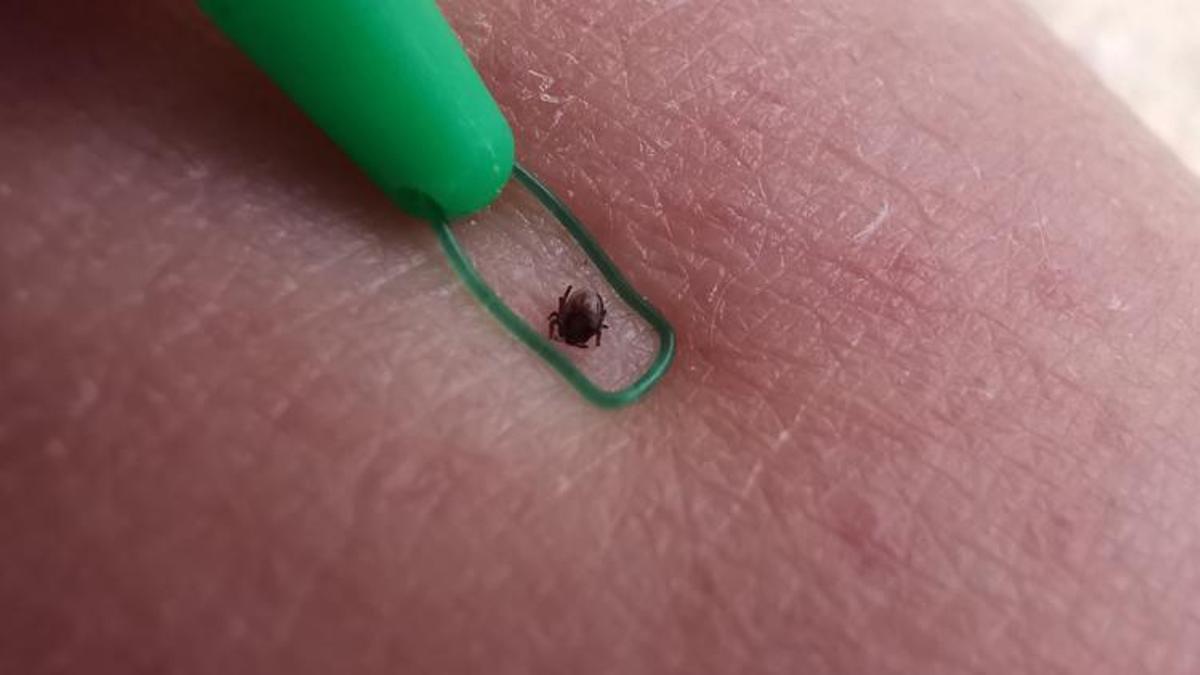 O ilde kene alarmı! 97 vaka tespit edildi