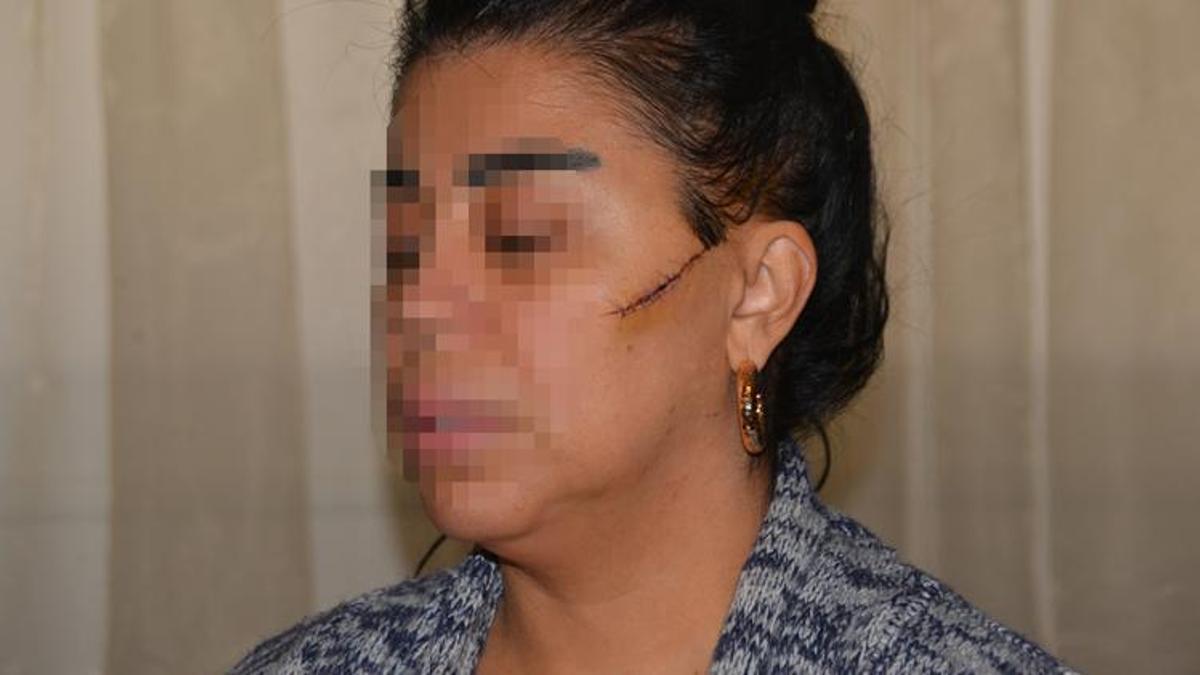 Eski sevgilisinin yüzünü usturayla kesen sanığa 'indirimsiz' 6 yıl hapis