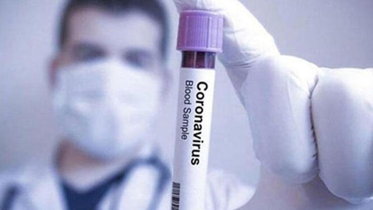 Araştırma: Midkin protein seviyesi koronavirüsün yeni belirtisi olabilir