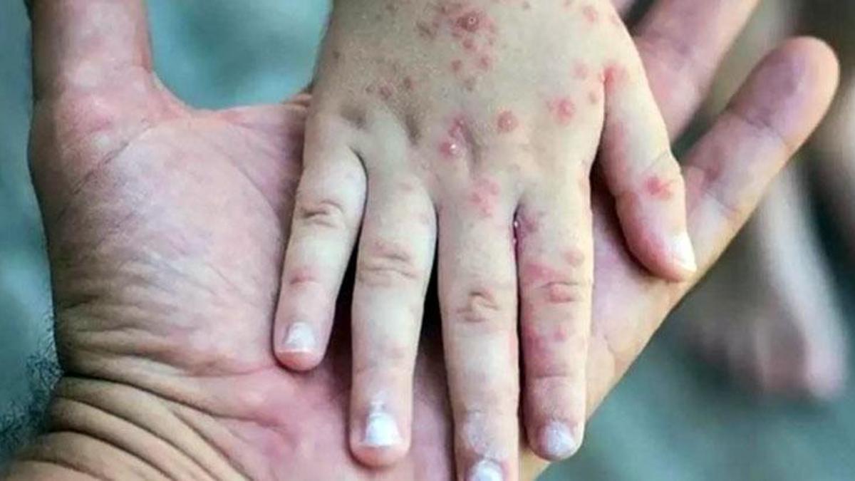 Komşuda ilk vaka geldi! Hemen alarm verildi