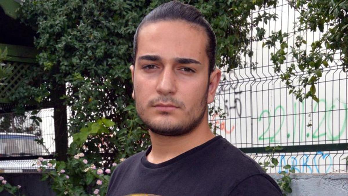 Oyunculuk hayali için 12 ameliyat geçirdi