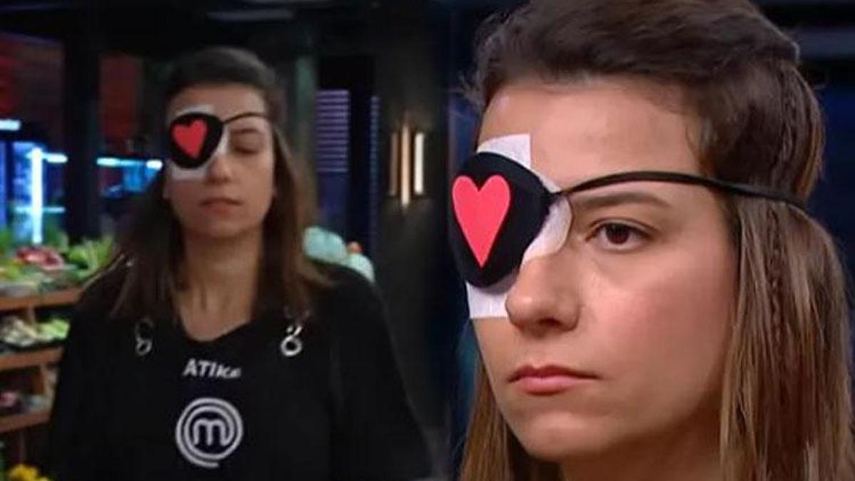 MasterChef Atike'nin gözüne ne oldu? MasterChef Atike'nin gözünde görme kaybı var mı?