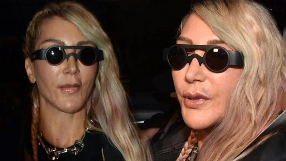 Hande Yener: Botoks yaptırarak mutlu oluyoruz!