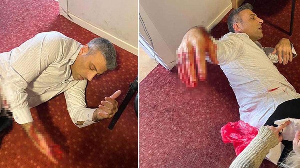 Yenilik Partisi Genel Başkanı Öztürk Yılmaz'a bıçaklı saldırı