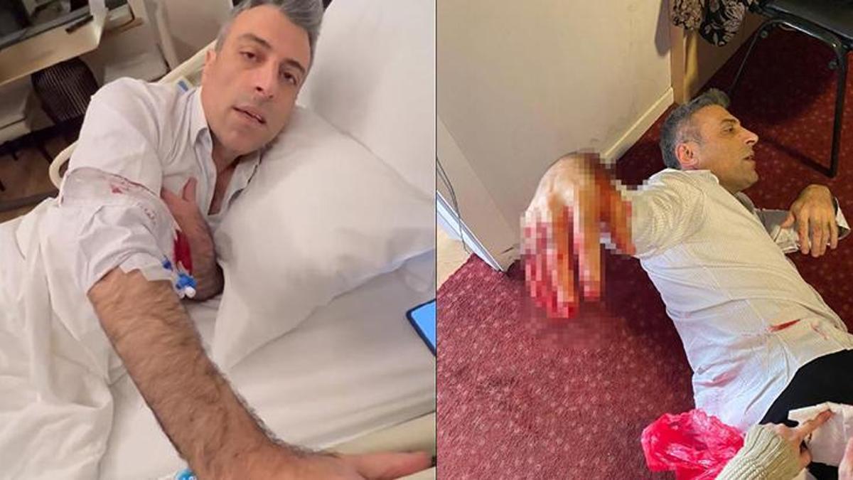Yenilik Partisi Genel Başkanı Yılmaz'a saldıran zanlı yakalandı