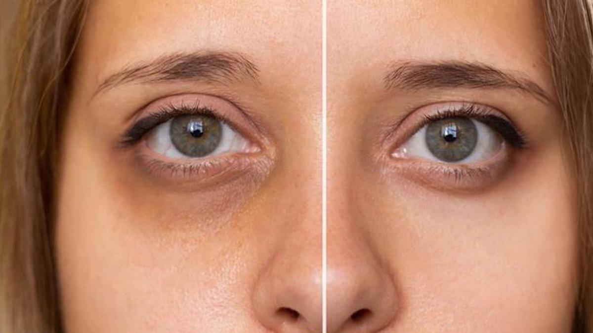 Gözaltı morluklarının sebebi belli oldu!