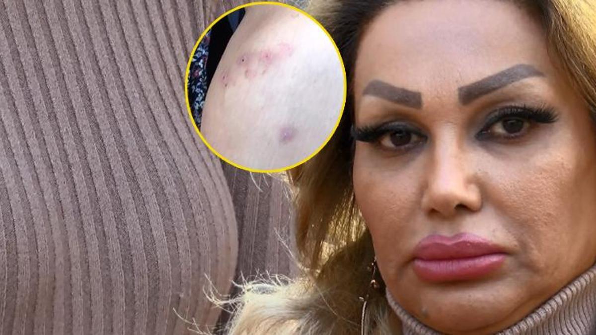 Sahte estetik ve güzellik merkezi skandalı sonrası kritik uyarı! Bunlar yoksa o doktora gitmeyin