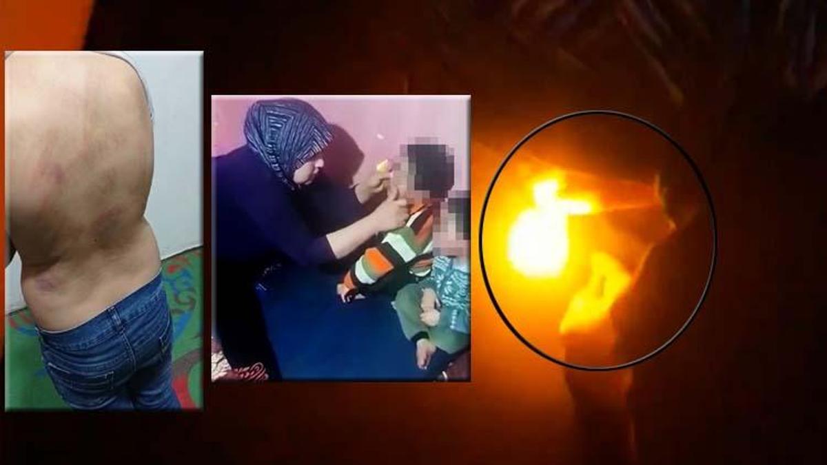 Ağzını bantlayıp çakmakla vücutlarını yaktı! Anne babanın yaptığı işkence dehşete düşürdü