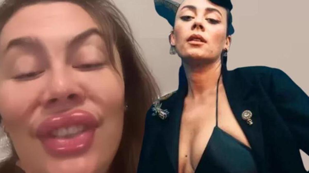 Demet Evgar, botoks ve dolguyu abartan isimleri tiye aldı