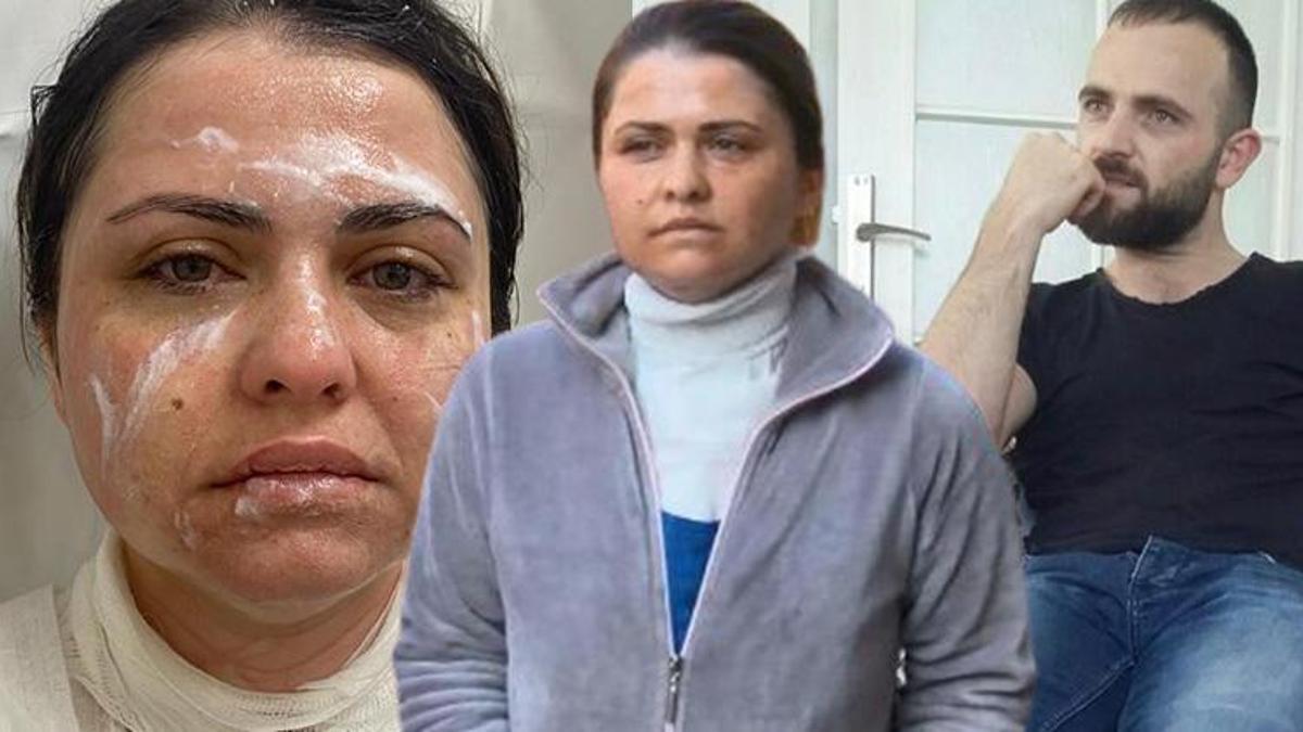 Eski eşine kimyasal madde ile saldırdı! 'Güzelliğine mi güveniyorsun?'