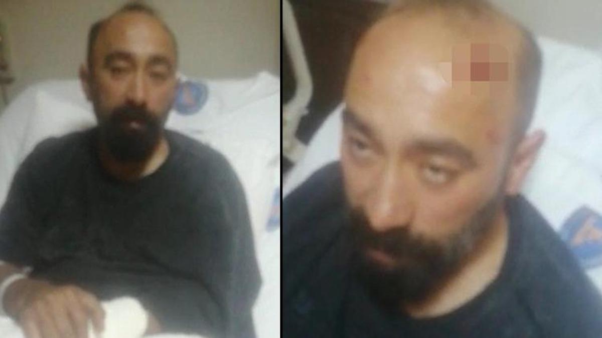 Müşteri gibi bindi, taksi şoförünü hastanelik etti! 'Boş araziye gitmek istiyorum'