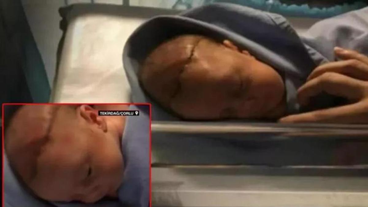 Doğumhanede dehşet! Doktor bebeğin başını neşterle kesti