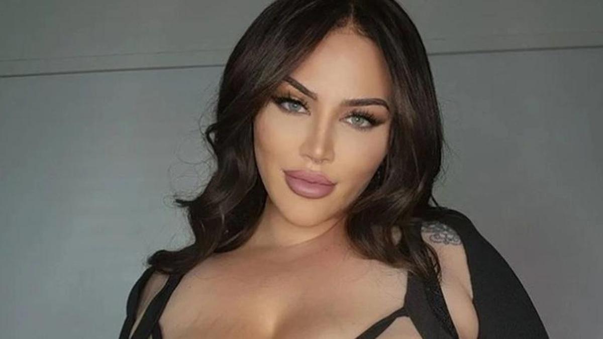 Dünyaca ünlü model göğüslerinin büyümesini durduramıyor! Gören estetik sanıyor ama gerçek başka