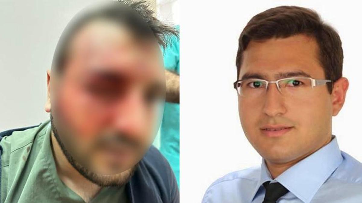 Doktorlar arasında ‘hastayı uyandır’ kavgası! Dehşet veren olay