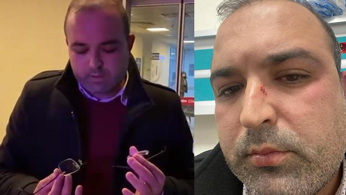 Arkadaşıyla yemeğe giden avukat, müşteriler tarafından darp edildi