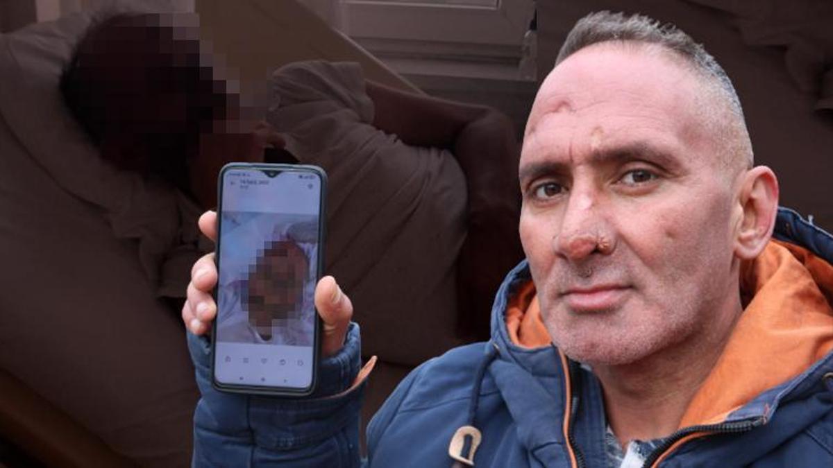 Her şey bir ısırıkla başladı! Sinek yüzünü tanımayacak hale getirdi