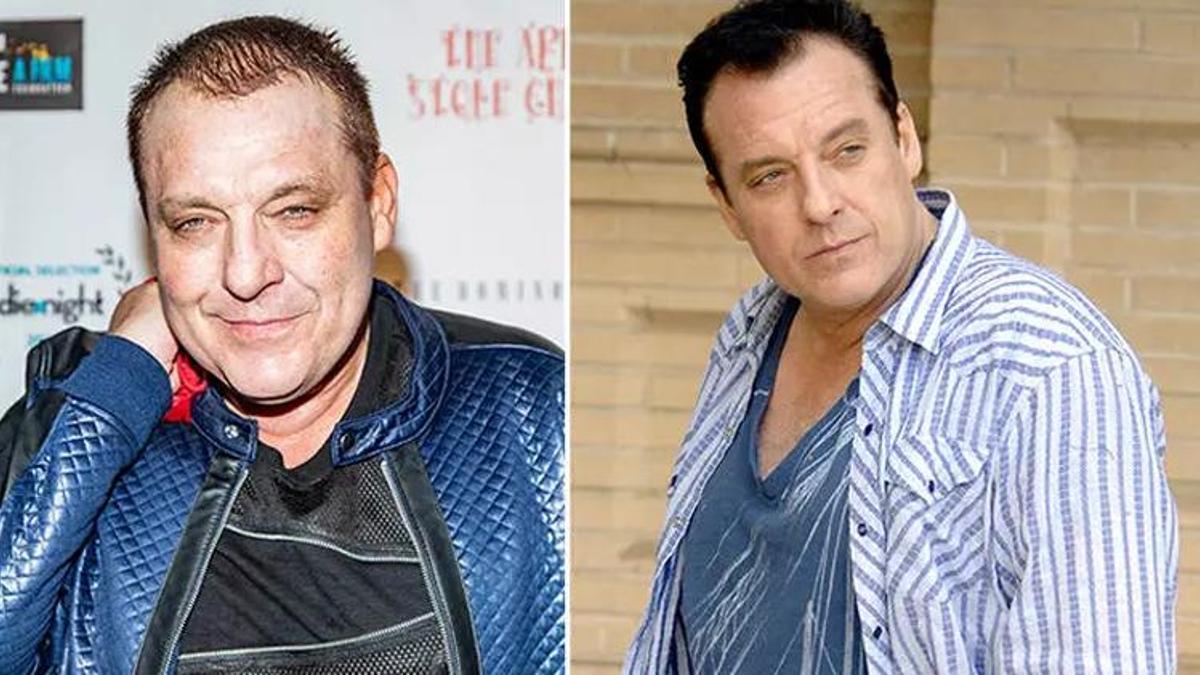 Tom Sizemore beyin anevrizması geçirmişti! Son durumu