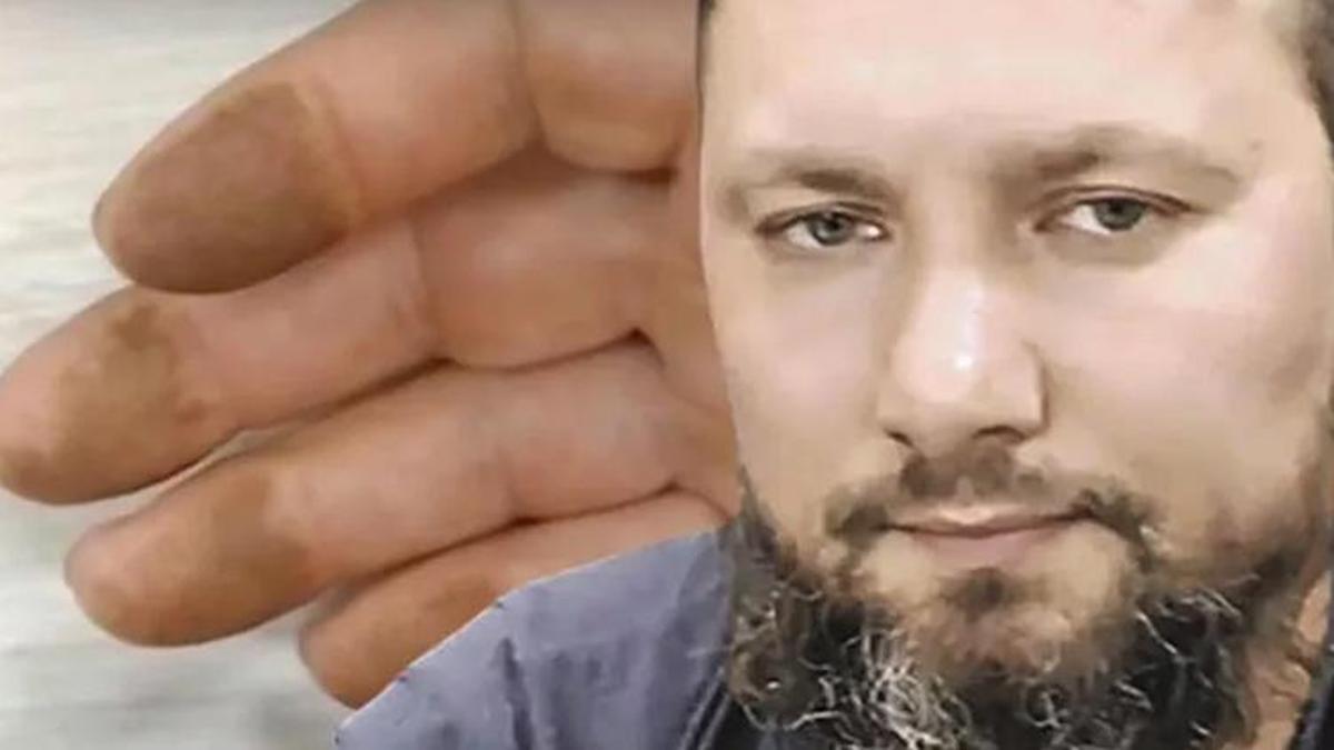 Yakalanmamak için parmak izlerini eritti, estetik ameliyat oldu! Yıllardır aranan cani yakalandı