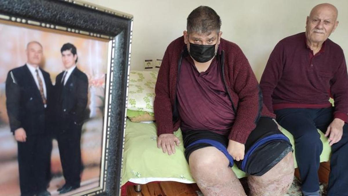 Otelde sivrisineğin ısırması sonrası hayatı kabusa dönmüştü! Kahreden haber geldi