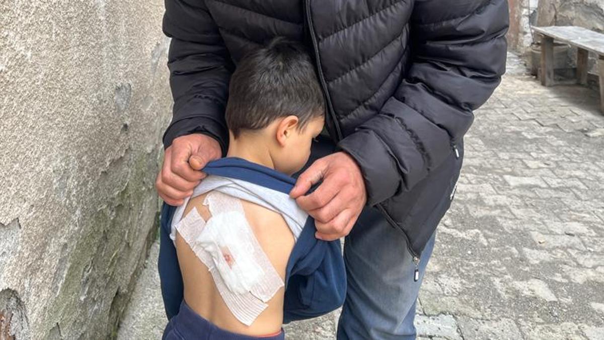 Sokak köpeklerinin saldırdığı 4 yaşındaki çocuk ölümden döndü
