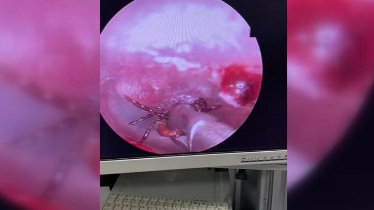 Kulak ağrısıyla hastaneye gitti, korkunç gerçek ortaya çıktı! Uzmanlar uyardı: Artarak devam edecek