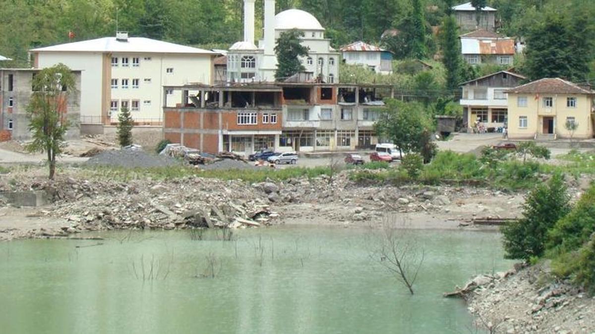 Dereden çıkan kopmuş ayak kenti karıştırdı! Sır olay sonrası 1 aile harekete geçti