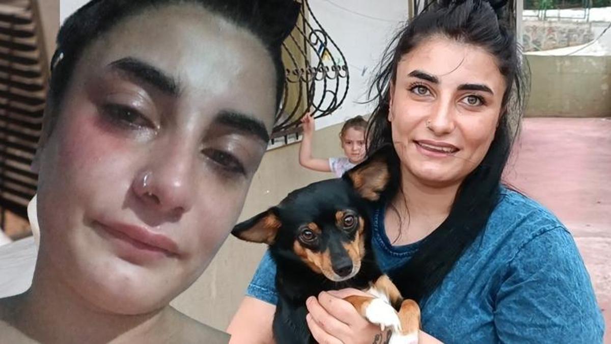 Hamile kadına ‘köpekle neden markete geldin’ şiddeti: Düşük yaptım