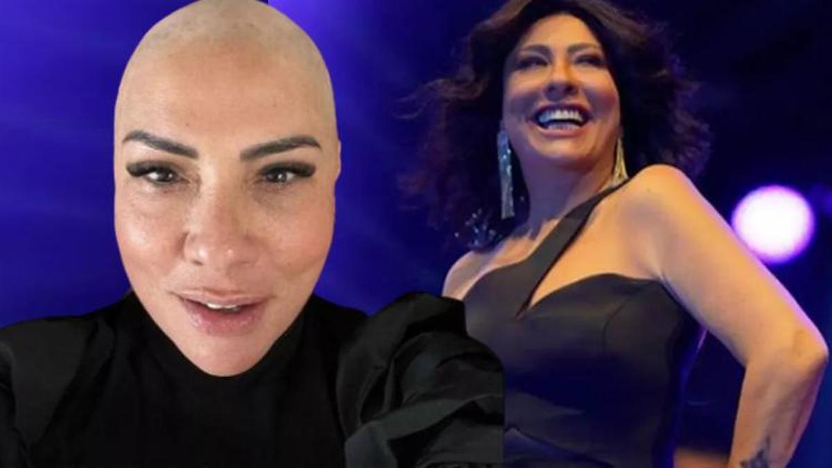 Saç kıran hastalığına yakalanan Işın Karaca peruksuz halini paylaştı