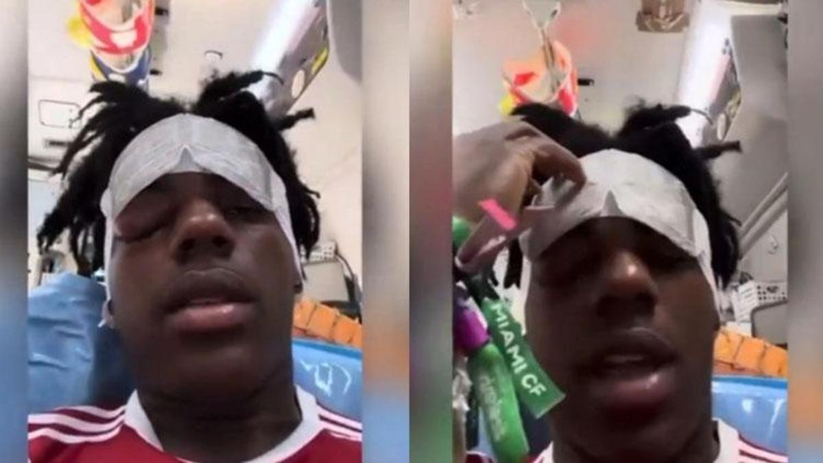 Küme Baş Ağrısı (Cluster Headache) nedir, ölümcül müdür? iShowSpeed’e ne oldu, Küme Baş Ağrısı neden olur, Cluster Headache tedavisi nasıl yapılır?