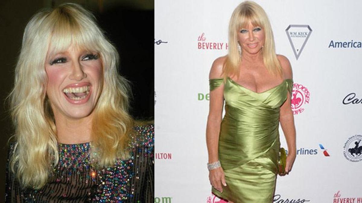 Suzanne Somers 23 yıldır mücadele ettiği kansere yenik düştü