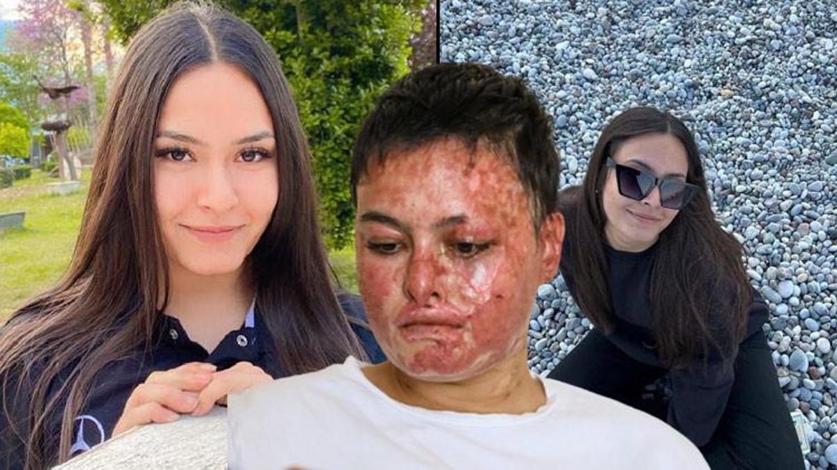 Liseli Beyzanur'un hayali olan iş hayatını kararttı! "Yeniden devam etmek istiyorum"
