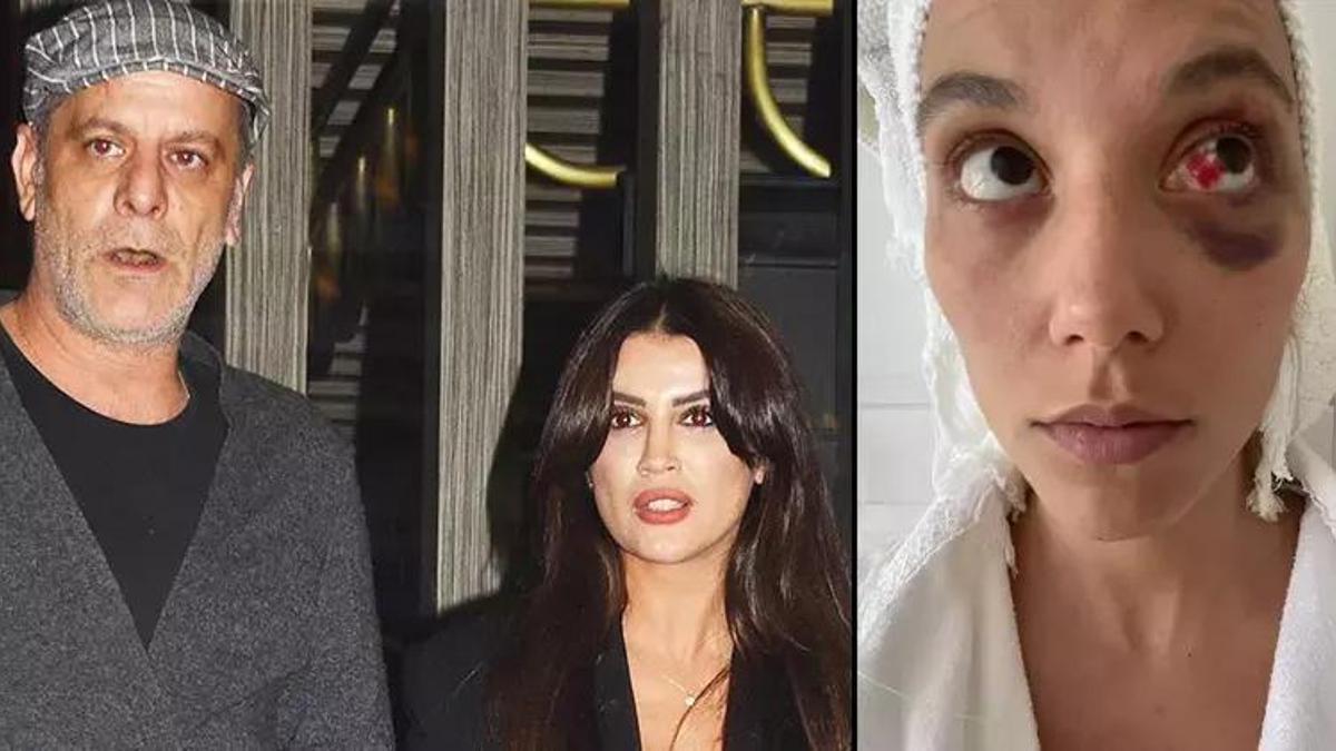 Ozan Güven günler sonra evden çıktı! Böyle görüntülendi