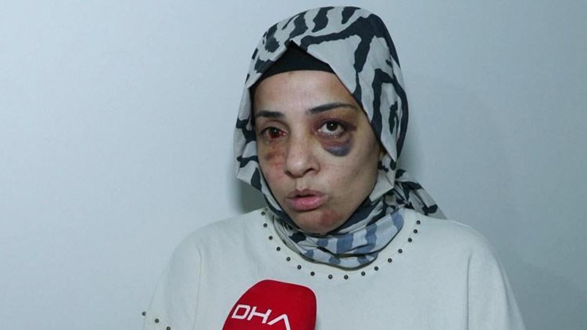 Eski eşinin ailesi tarafından sokak ortasında dövülen kadının yardım çağrısı! Kan donduran olay