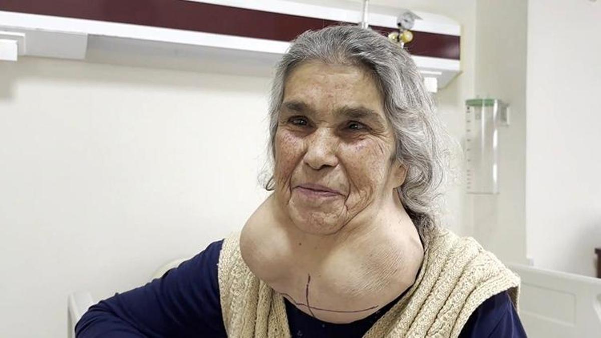 Doktordan korktuğu için 50 yıl böyle yaşadı! Ameliyat sonrası sözleri şaşırttı