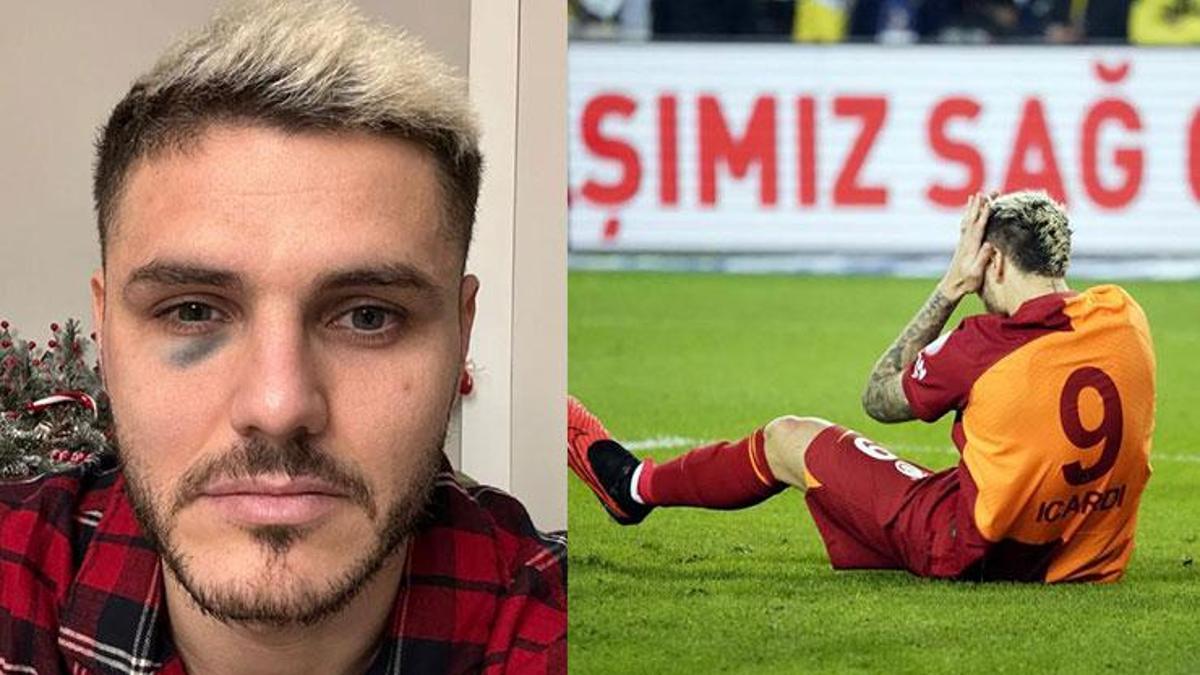 Galatasaray, Icardi'nin morluğunu paylaştı! Fenerbahçe ve Dzeko'dan yanıt gecikmedi