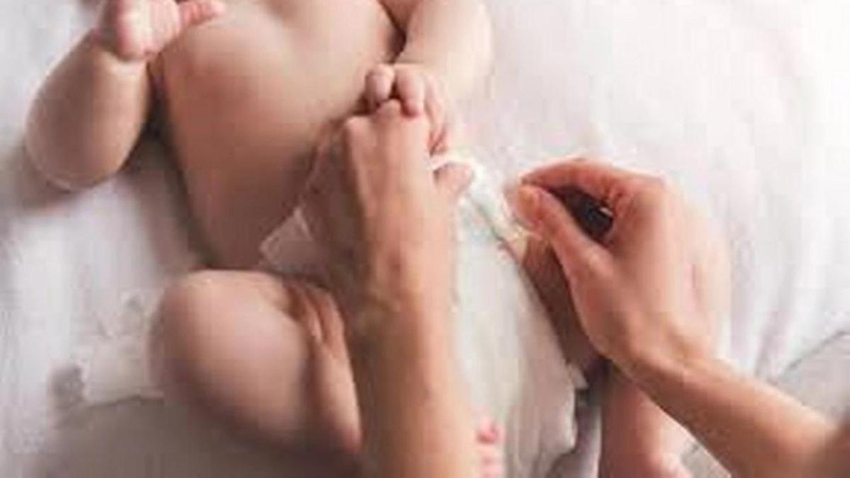 Pişik Nasıl Geçer? Pişik Geçiren Yöntemler, Püf Noktaları Nelerdir?