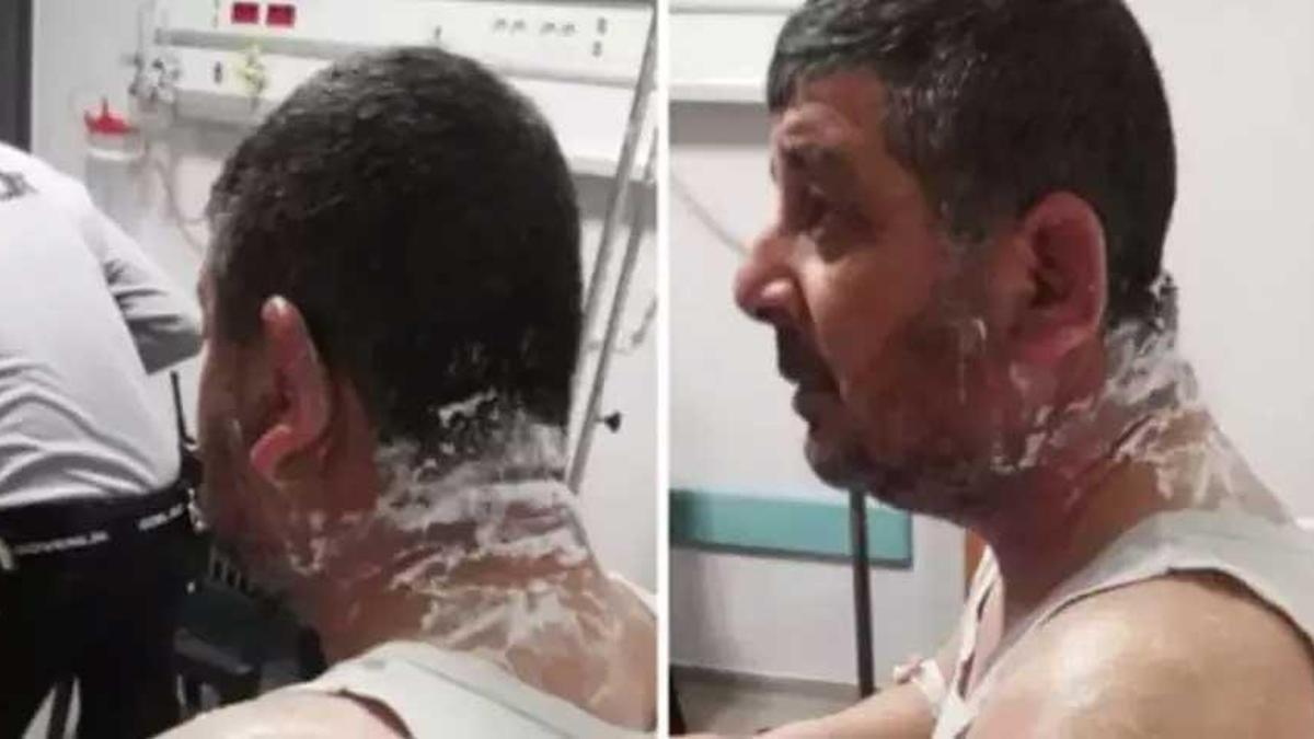 Ev sahibi dehşeti: Kiracısının yüzüne asit döktü!