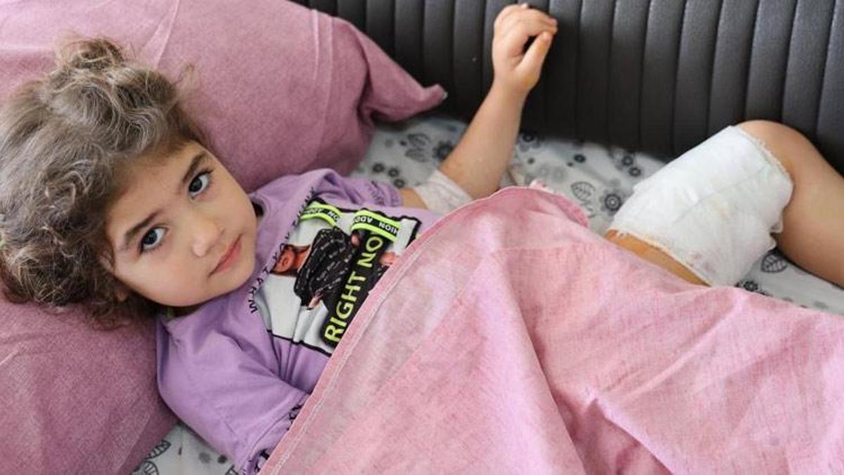 Adana'da küçük kız dehşeti yaşadı! "Köpek de sahibi de tutuklansın"