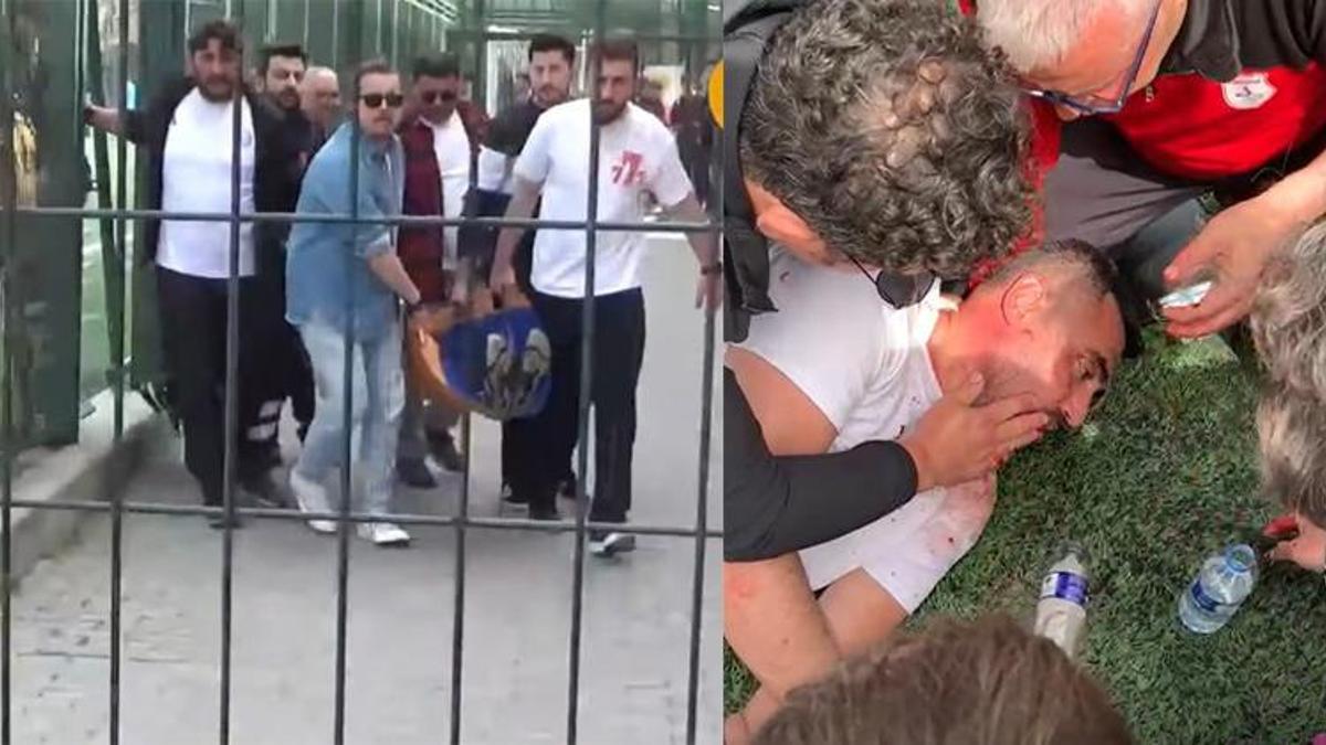 Kavgada yüzüne tekme geldi! Dili boğazına kaçtı