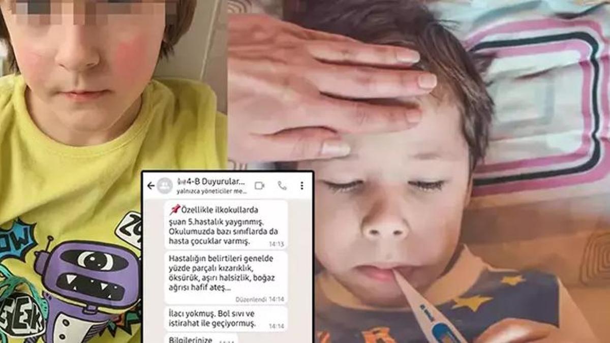 Çocuk enfeksiyonlarına dikkat! Beşinci hastalık'ta artış var..