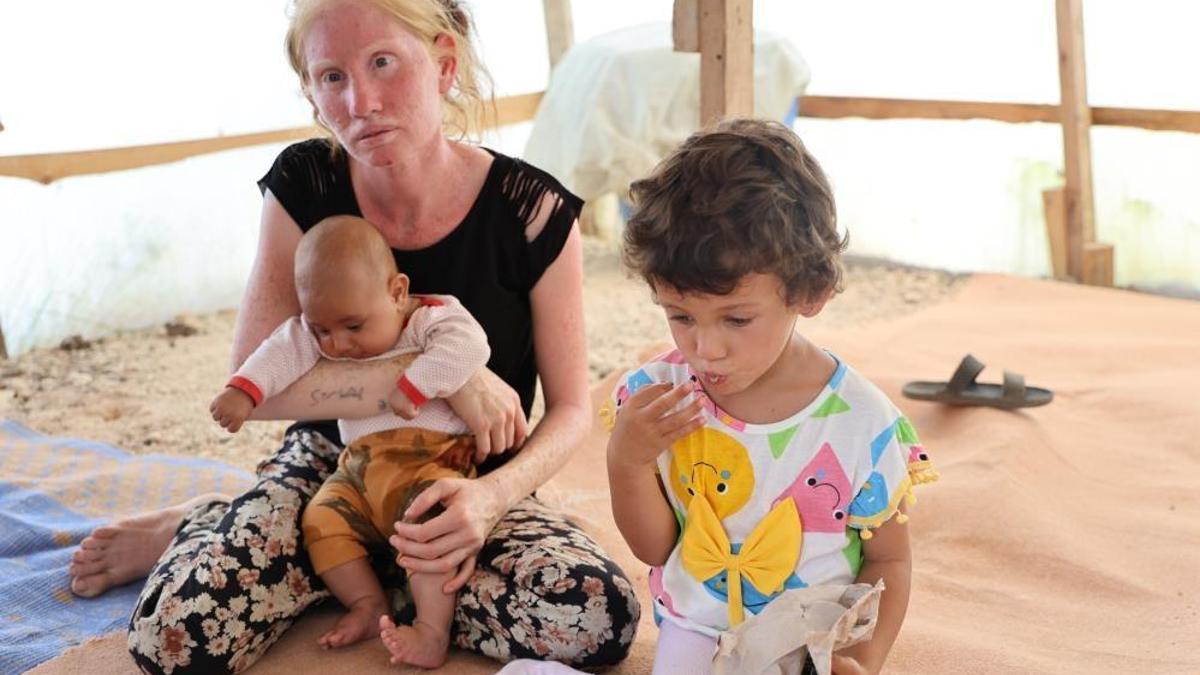 Adanalı albino anne sıcaklara karşı yaşam mücadelesi veriyor