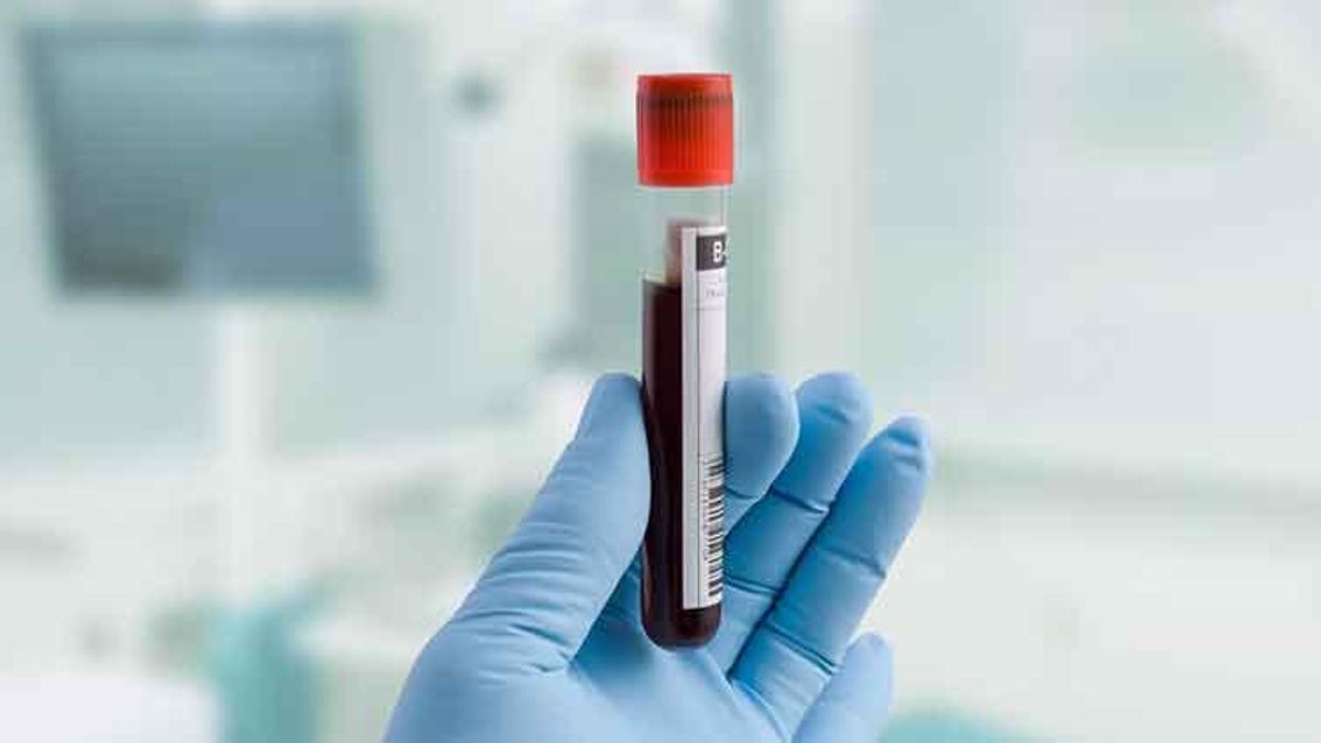 Adana'yı karıştıran olay: Trans bireyin HIV sonucu pozitif çıktı