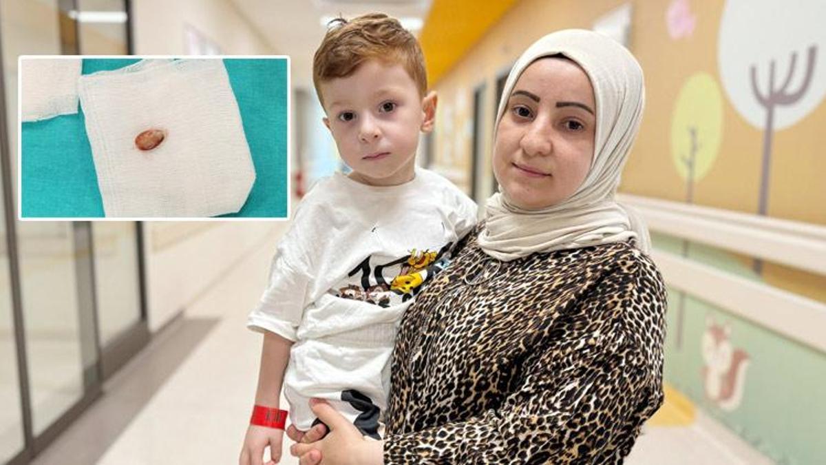 3 yıl boyunca denemediği tedavi kalmamıştı, nefes borusundan çıktı! Doktorları bile şaşırtan vaka