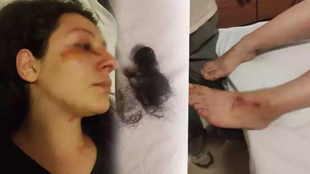 Bursa'da kedi dayağı: Besledikleri kediyi öldüren baba- oğul tarafından darp edildi!